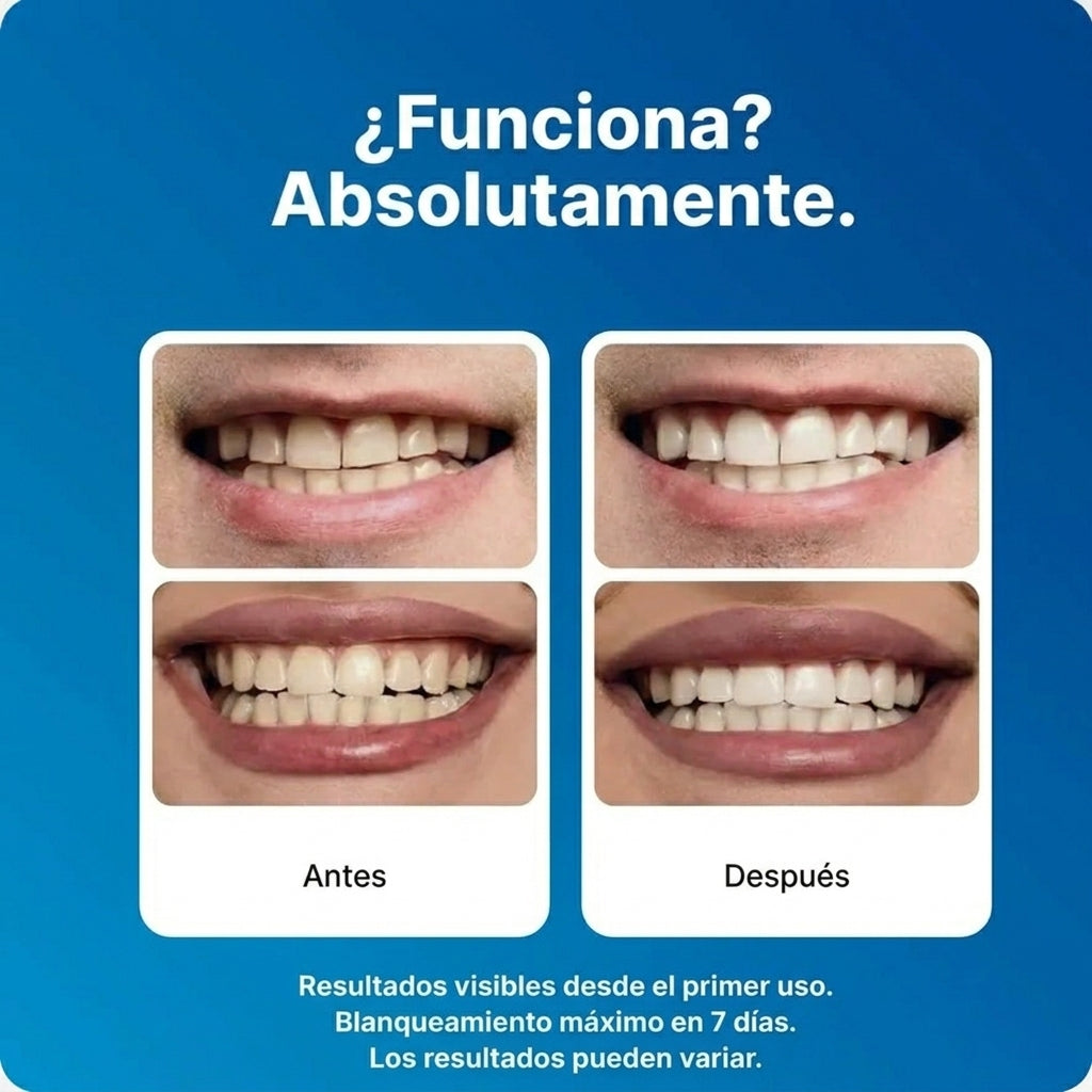 Tiras dentales - 5D White®️