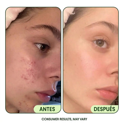 Almohadillas Faciales Renovadoras con Centella Asiática, Colágeno y Niacinamida
